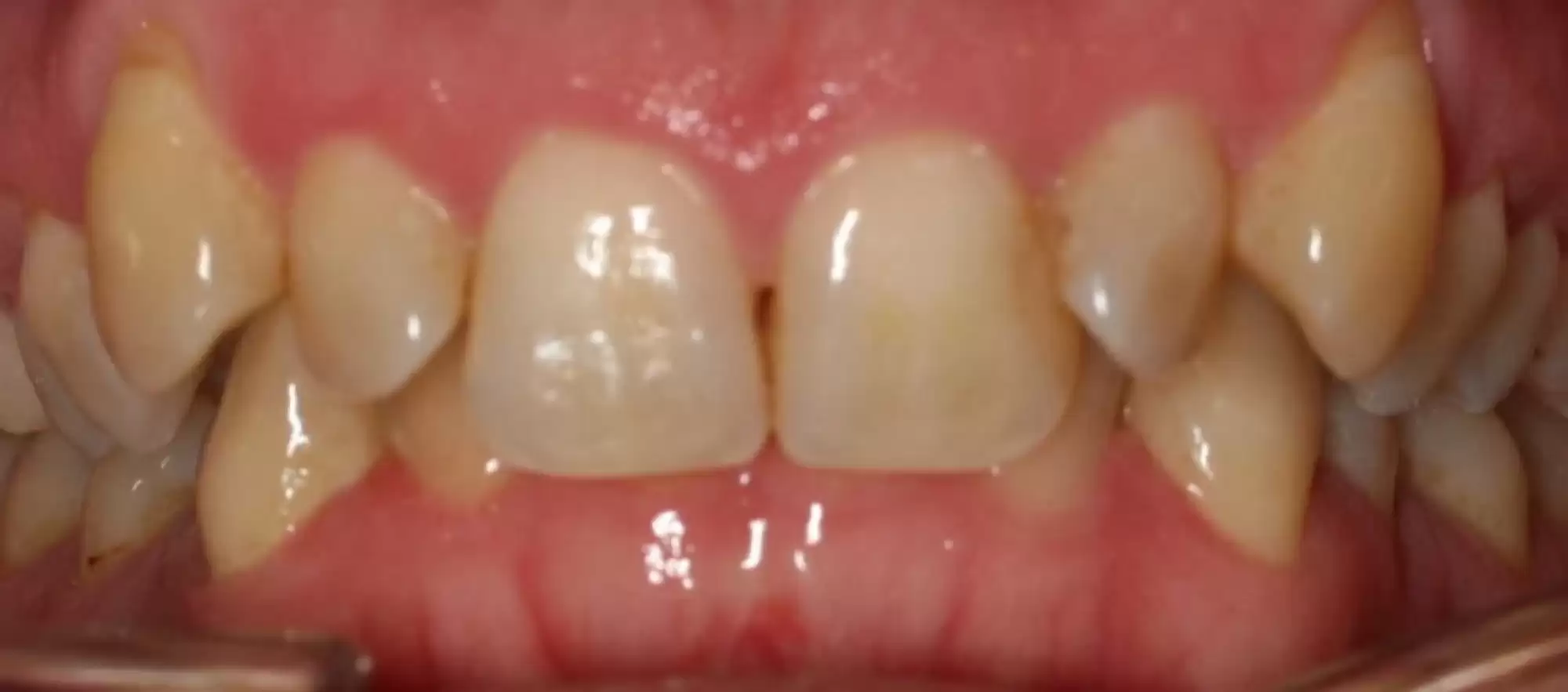 Jessica Crabtree Initial photo